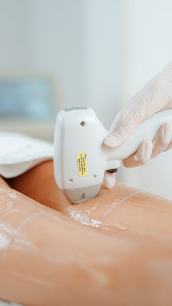 IPL & SHR – Prestige Beauty Düsseldorf