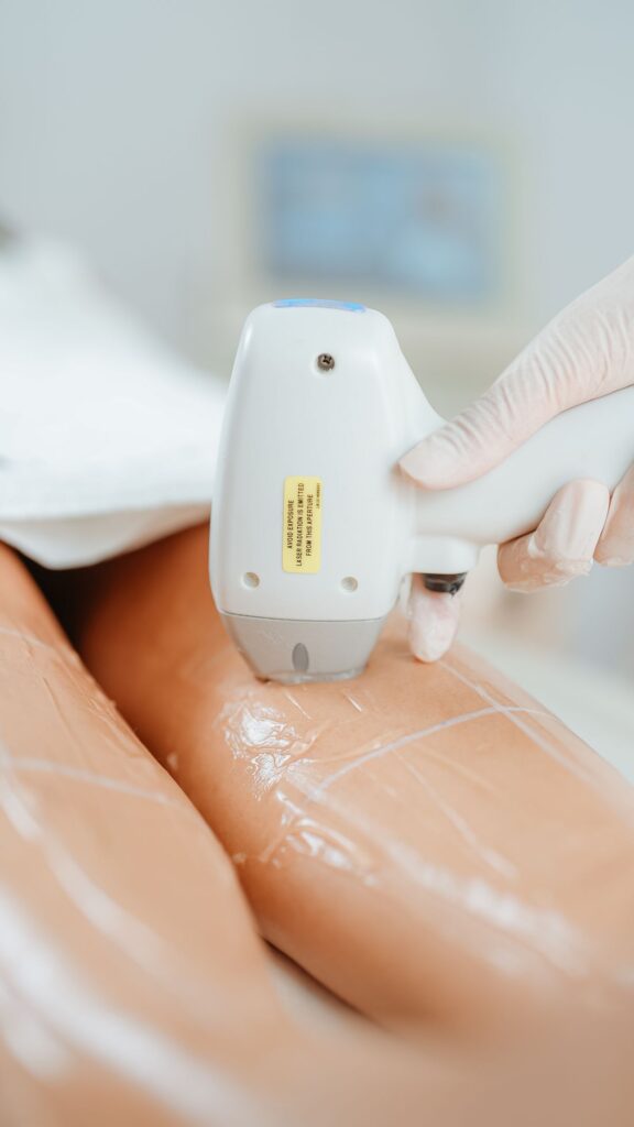 Laser-Haarentfernung – Prestige Beauty Forming Düsseldorf